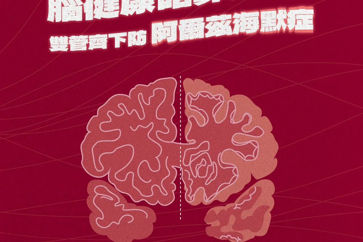腦健康唔靠運氣：小習慣＋小檢查，守護大腦健康